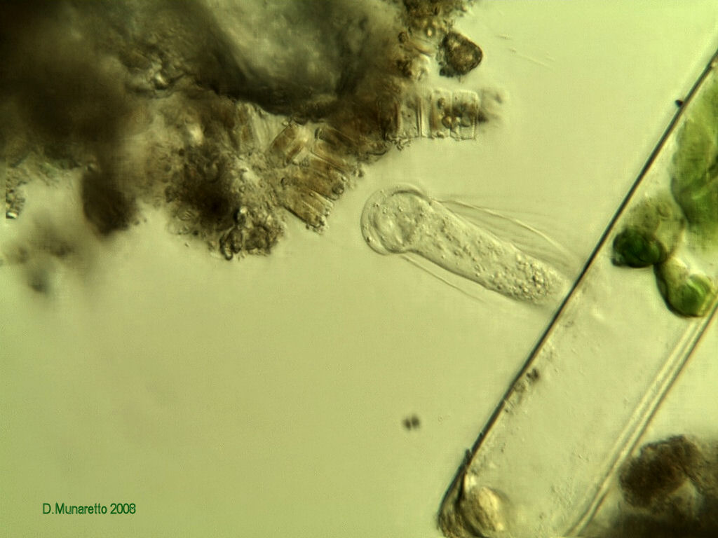 Cothurnia o Vaginicola?